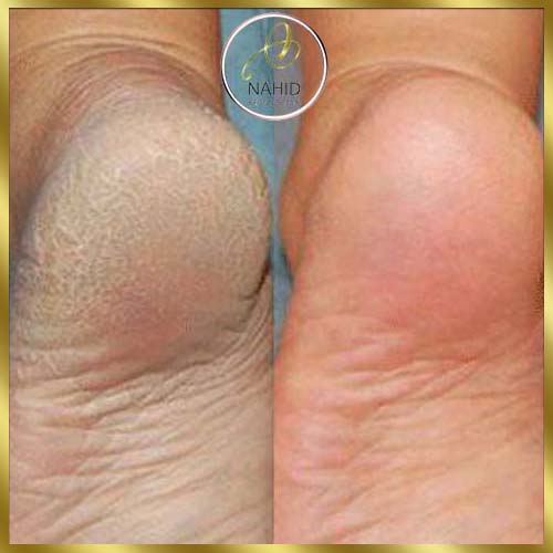 گالری پدیکور